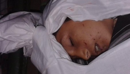 په غزني کې دماشومانو دشهادت په اړه د تسلیت پیغام او څرګندونې